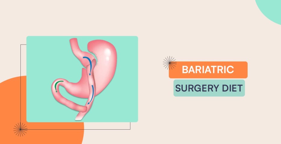 Bariatric Surgery diet