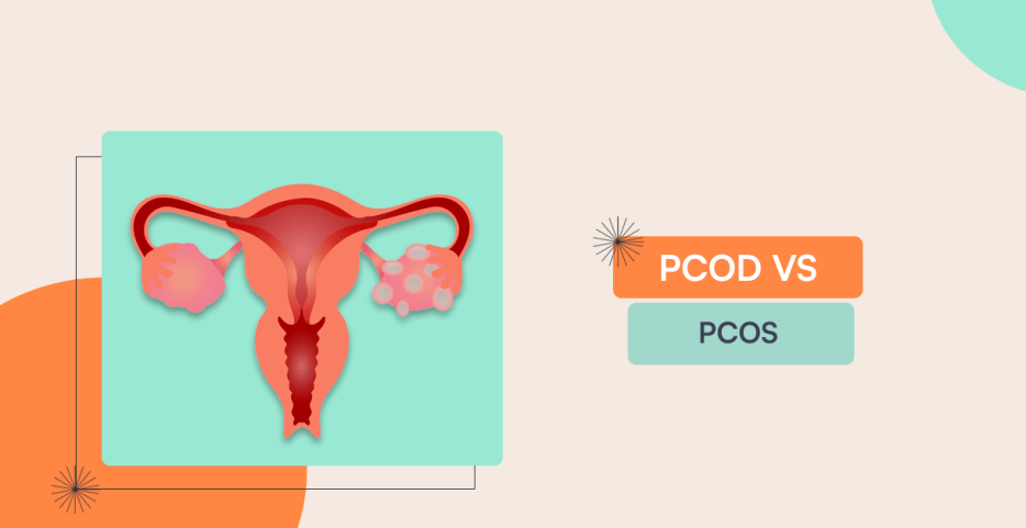 PCOD vs PCOS