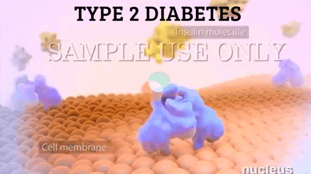 symptoms of diabetes: Type 2 diabetes