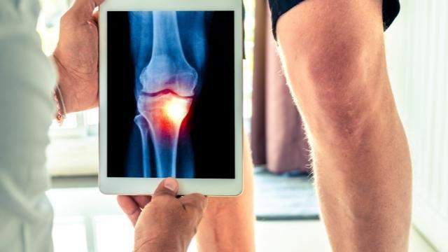 what is osteoarthritis